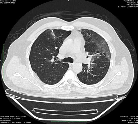 Diagnostic Centre | Best Diagnostic Centre in Udaipur