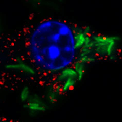 WHO in Western Pacific urges action to end tuberculosis by 2030 ...