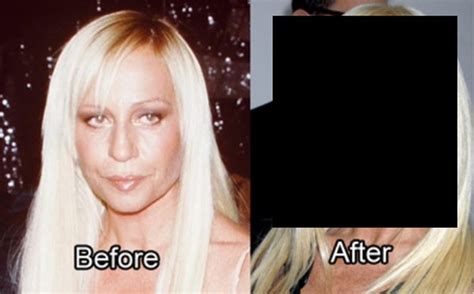 Plastic Surgery Disasters 的图像结果