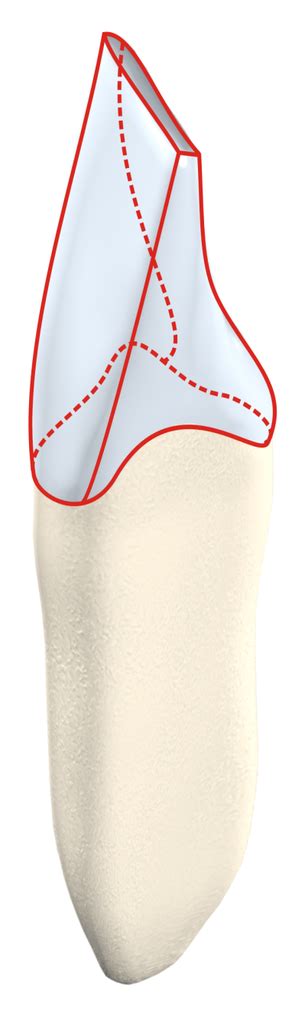 Line Angle Teeth 的图像结果