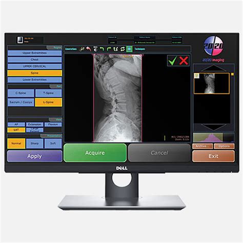 Image result for Chiro Software