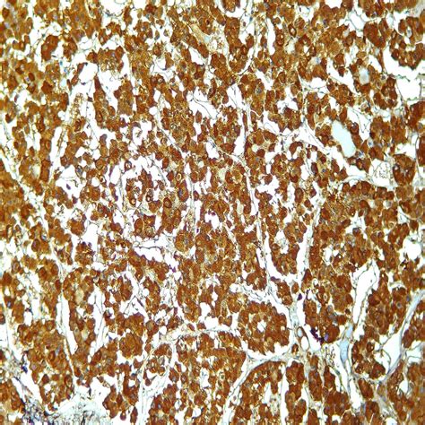 ACTH antibody - AH26+57 | PathnSitu Biotechnologies