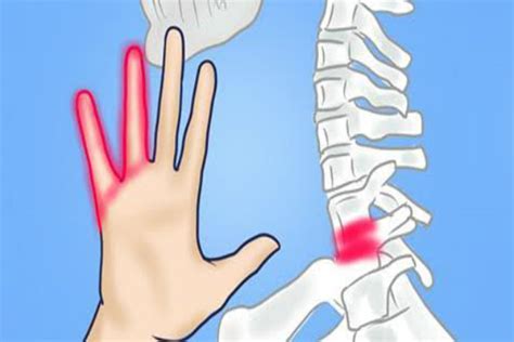 Why Do Have Numb Hands? 7 Reasons To Pay More Attention To Your Health ...