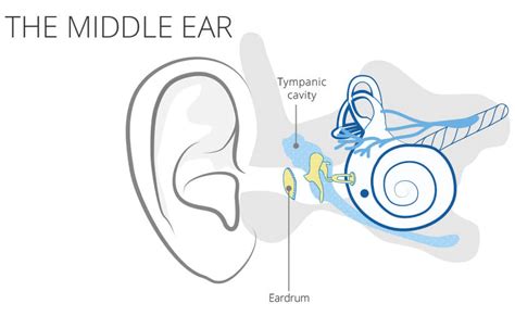 Tympanic effusion | Symptoms, Cause & Treatment | audibene.ch