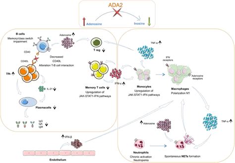 Deficiency of Adenosine Deaminase 2 - Rheumatic Disease Clinics