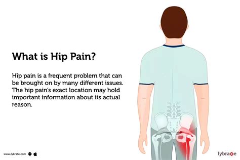 Hip Problem Pain 的图像结果
