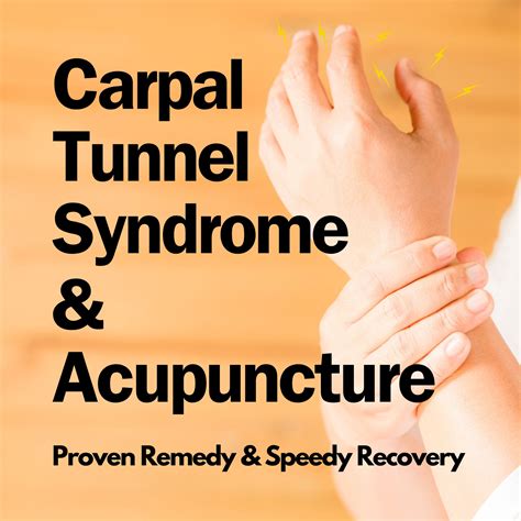 Carpal Tunnel Syndrome & Acupuncture: Proven & Speedy Remedy