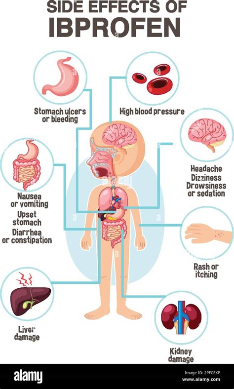 Human anatomy diagram cartoon style of ibuprofen side effects ...
