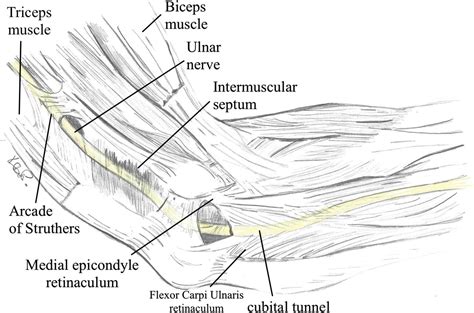 Ulnar Nerve - Clinical Tree
