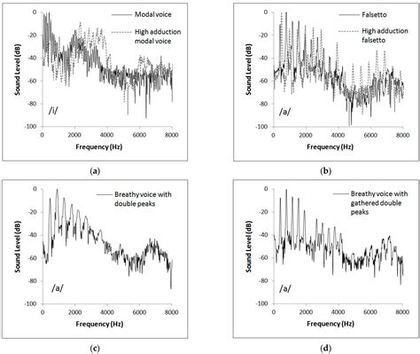 Electroglottographic Analysis of the Voice in Young Male Role of Kunqu ...
