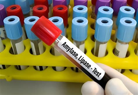 Amylase and Lipase Levels Chart: Normal, Low and High Ranges Explained
