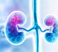 kidney 的图像结果