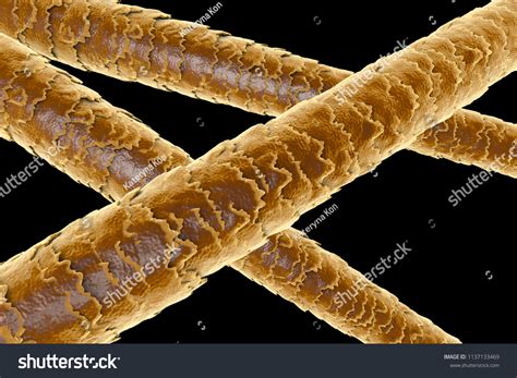Hair Under Microscope Labeled