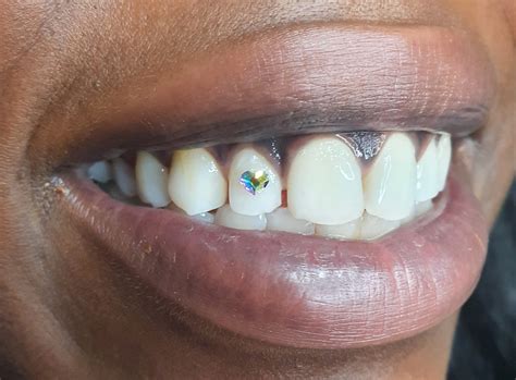 Image result for DIY Tooth Gems