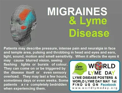 lyme disease headache location