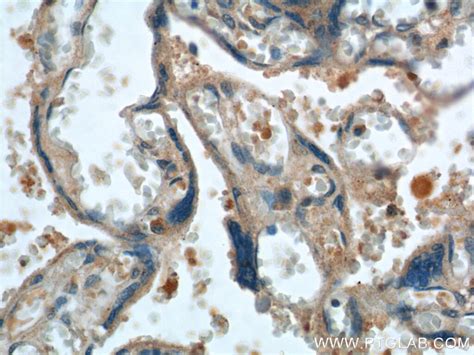 FGF5 antibody (18171-1-AP) | Proteintech