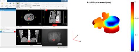 Image result for Medical Image Segmentation MATLAB