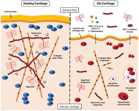 Polymeric Nanoparticles for Drug Delivery in Osteoarthritis