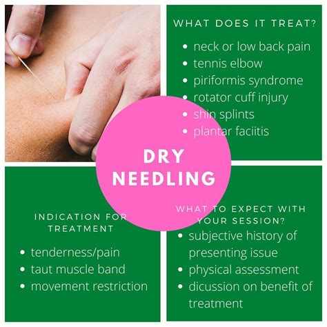 Dry Needling Explained - Inner Strength Bayside