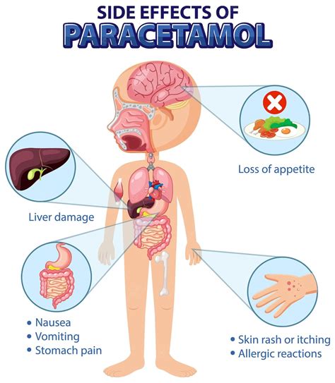 Diagrama de anatomía humana estilo de dibujos animados de efectos secundarios de paracetamol ...