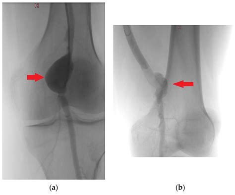 JCM | Free Full-Text | A Five-Year Retrospective Study from a Single Center on the Location ...