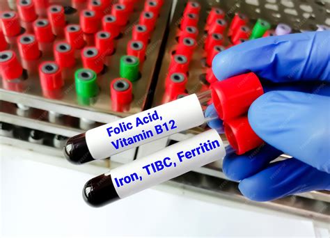 Vitamin B12 Deficiency And High Ferritin at Mikayla Whish blog