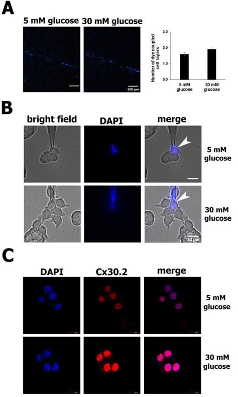 Protector Role of Cx30.2 in Pancreatic β-Cell against Glucotoxicity ...