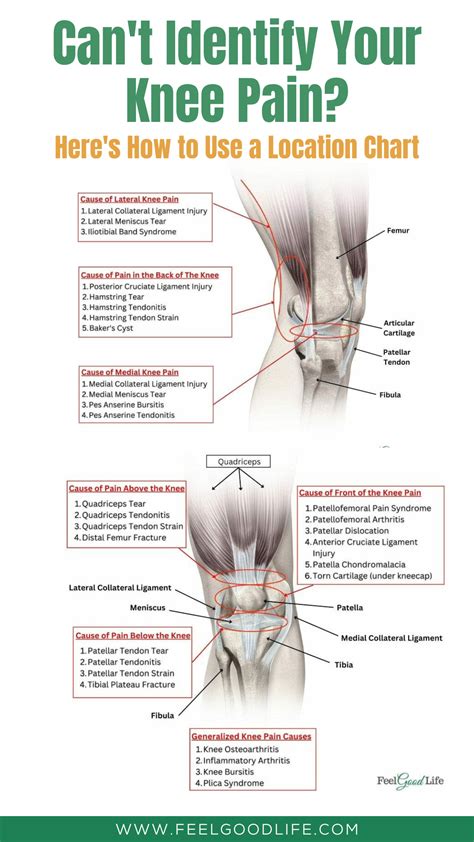 Can't Identify Your Knee Pain? Here's How to Use a Location Chart | Knee pain relief remedies ...