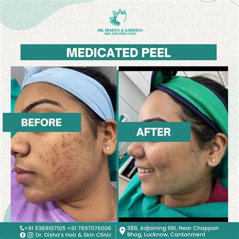 Best dermatologist in Lucknow- Dr Disha’s Hair & Skin Clinic- Skin Specialist Lucknow, Skin ...