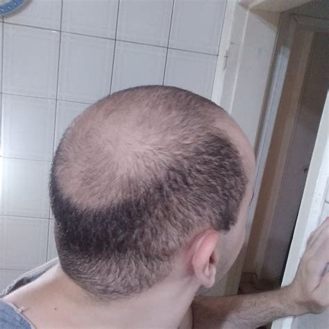 my hair in 1 guard buzzcut does it fits me?plus am i weird for loving ...