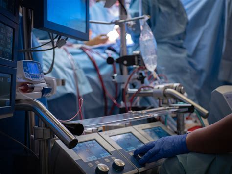 What Does A Perfusionist Do