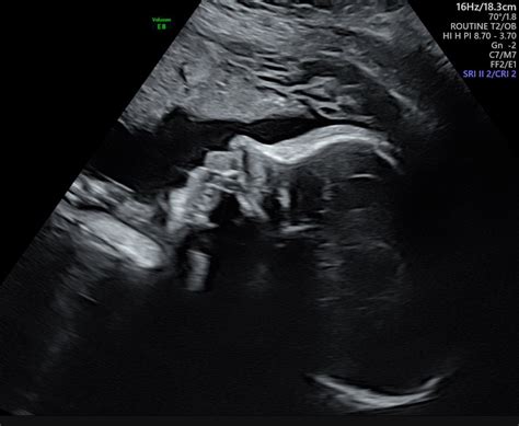 Growth Scans — Trinity Imaging