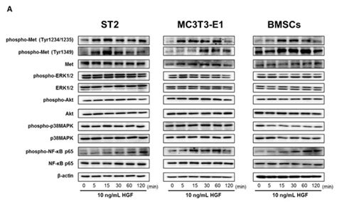 The HGF/Met/NF-κB Pathway Regulates RANKL Expression in Osteoblasts and ...