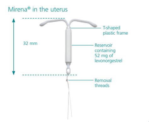 Mirena® Coil | 52mg Levonorgestrel Intrauterine System|Bayer
