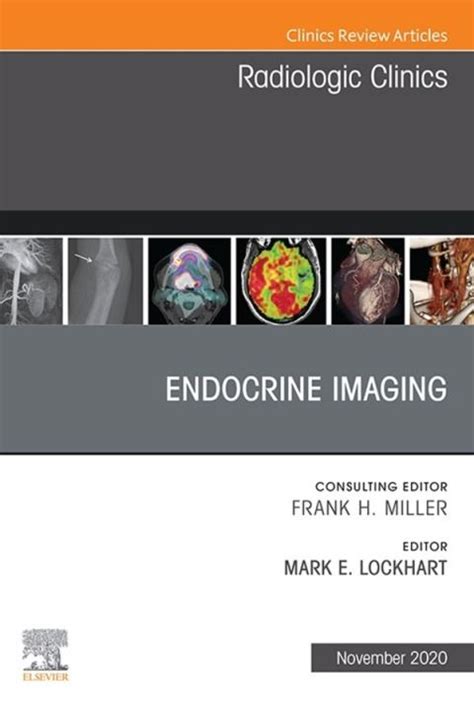 Endocrine Imaging, An Issue of Radiologic Clinic: 1st edition | Edited ...