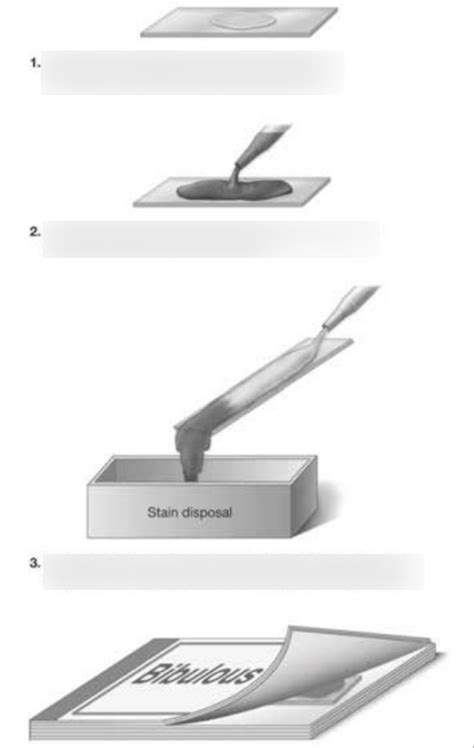 Image result for Simple Stain Procedure