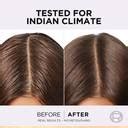 L'Oréal Paris Hyaluron Pure 72H Purifying Shampoo for Oily Scalp, Dry ...