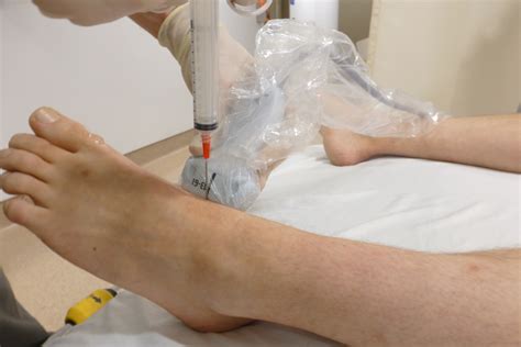 Image result for Ankle Anterolateral Approach Injection