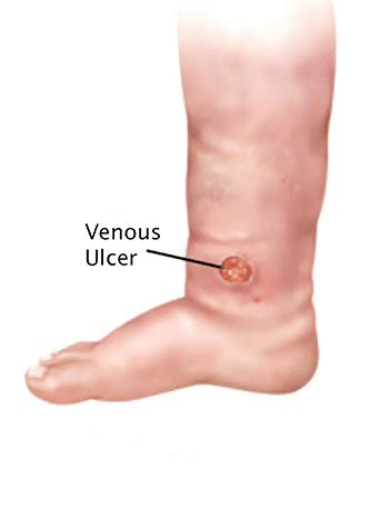 Dr. Avik Bhattacharya Expert Interventional Radiologist in Kolkata