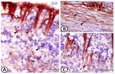 Ependymal and Neural Stem Cells of Adult Molly Fish (Poecilia sphenops ...