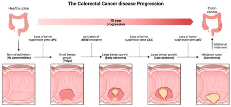 Colorectal Cancer: Disease Process, Current Treatment Options, and Future Perspectives