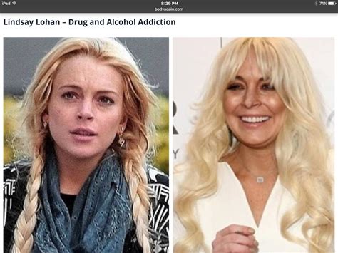 Pin by happygal831 on BEFORE. &. AFTER | Celebrities, Lindsay lohan ...