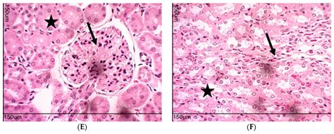 Th1-Biased Immunomodulation and In Vivo Antitumor Effect of a Novel ...