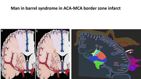vascular supply of brain and spinal cord - Copy.pptx