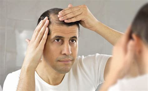 आयुर्वेदिक तरीकों से इस तरह रोंके बालों का झड़ना, रोजाना नहीं होगा Hair ...