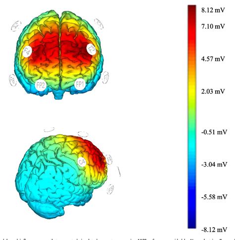 Image result for Dorsolateral Prefrontal Cortex