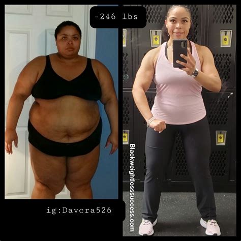 DaVina lost 246 pounds - Black Weight Loss Success