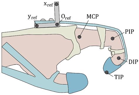 Design Optimization of a Soft Robotic Rehabilitation Glove Based on ...
