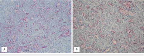 Image result for Acid-Fast Bacilli Staining Method