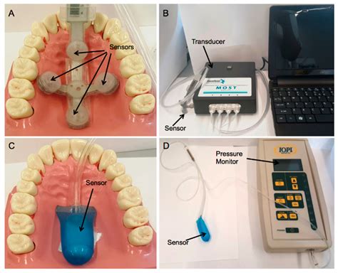 Use of Superelastic Nitinol and Highly-Stretchable Latex to Develop a ...